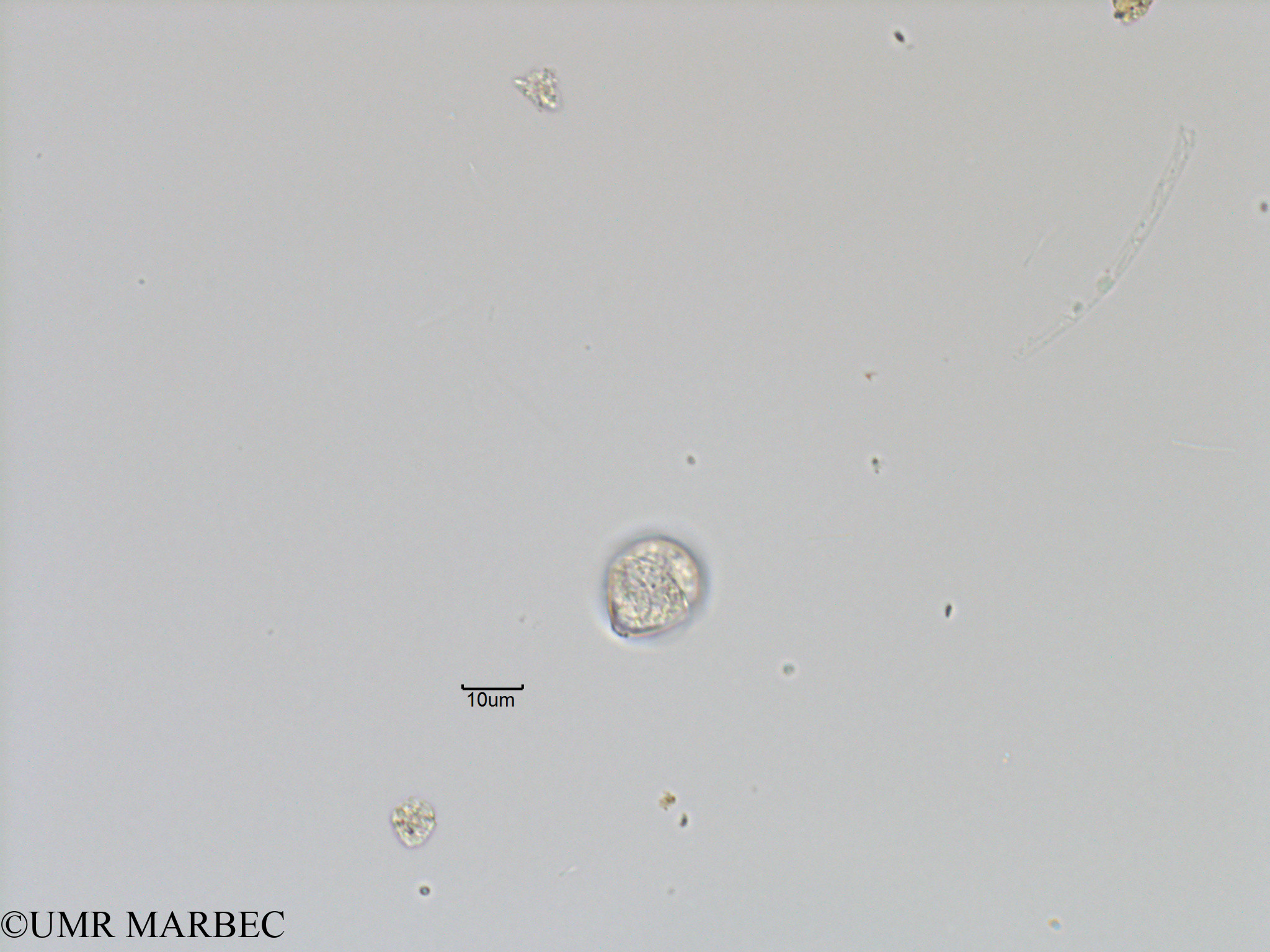 phyto/Bizerte/bizerte_bay/RISCO November 2015/Scrippsiella spp (Baie_T5-C1-Scrippsiella2 ou dino6-2).tif(copy).jpg